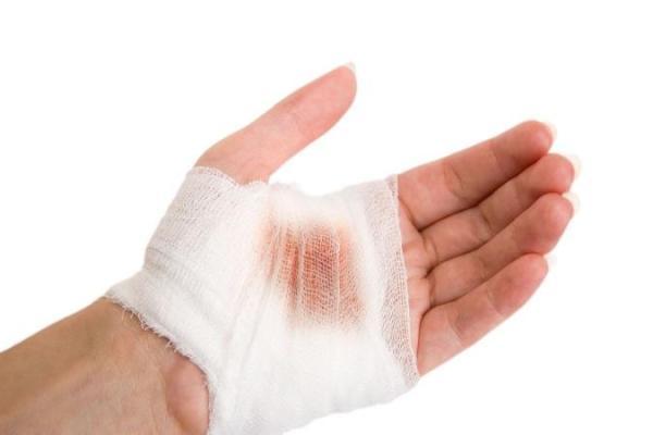 روش های خانگی برای قطع خونریزی زخم