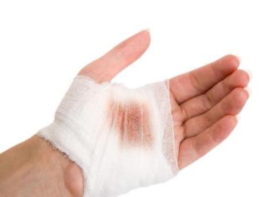 روش های خانگی برای قطع خونریزی زخم